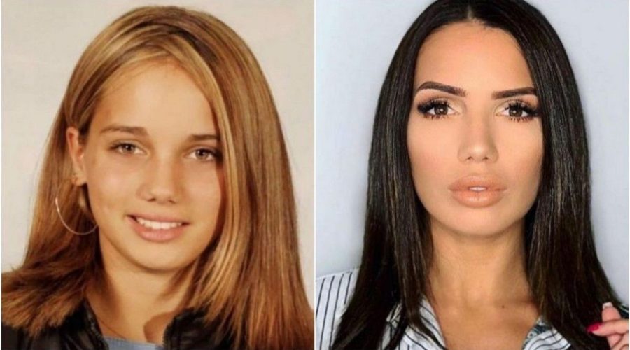 Manon Tanti Avant Chirurgie