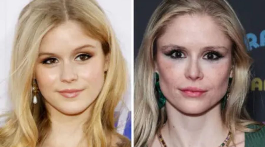 Erin Moriarty Chirurgie