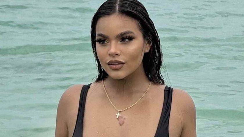 Gracie Bon Avant Chirurgie