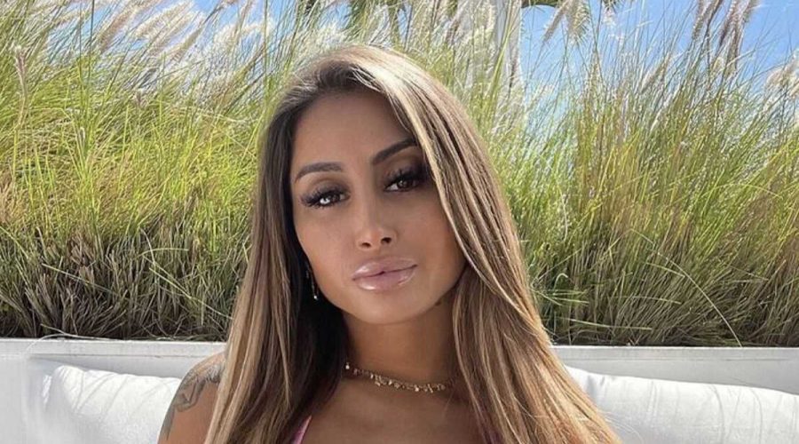 Oceane Avant Chirurgie