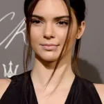 Kendall Jenner Avant Chirurgie