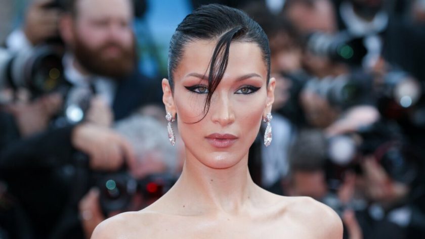 Bella Hadid avant chirurgie