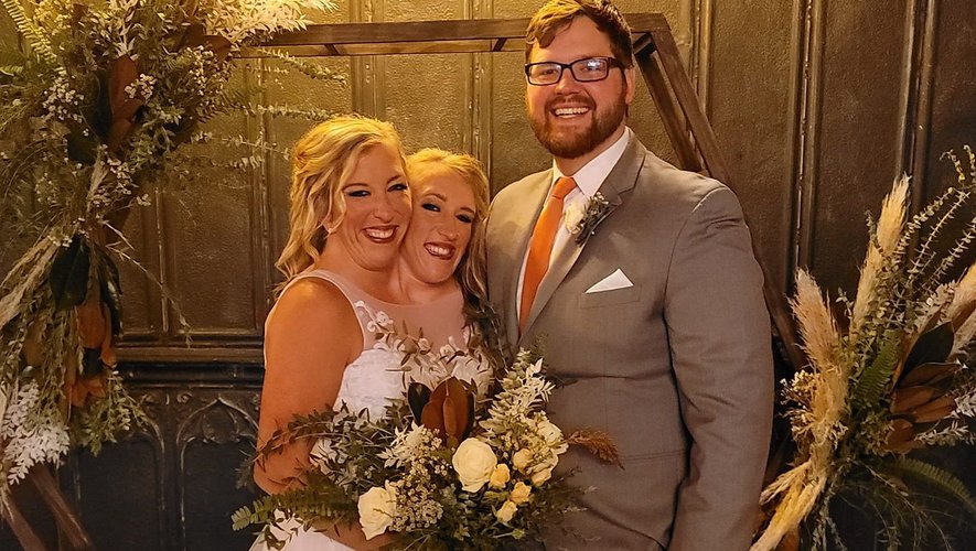 Abby et Brittany Mariage