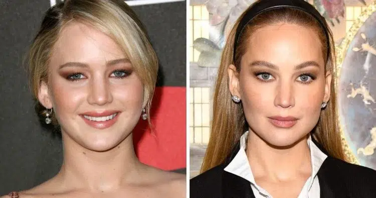 Jennifer Lawrence Chirurgie